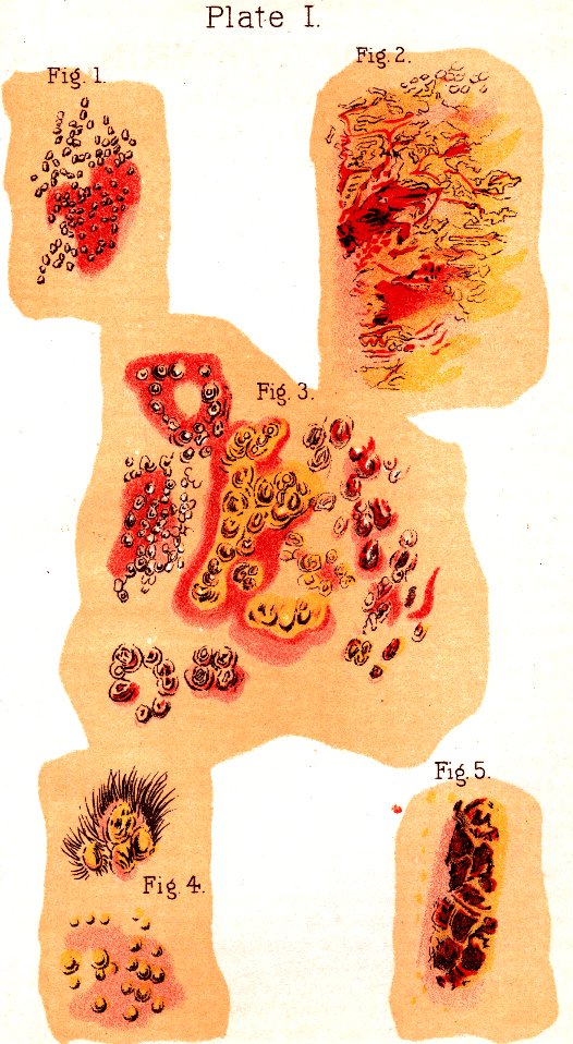 Illustration:
Plate I. Fig. 1. Fig. 2. Fig. 3. Fig. 4. Fig. 5.