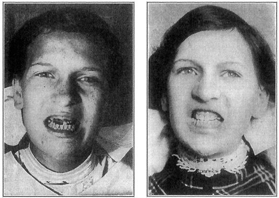 TEETH&mdash;A QUESTION OF CARE